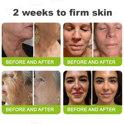 👨‍⚕️Made and shipped from the UK 💫Rolimey® Botox & Vita-A Retinol Shot Wrinkle-Lift Tightening cream - Last Day Promotion 70% OFF
