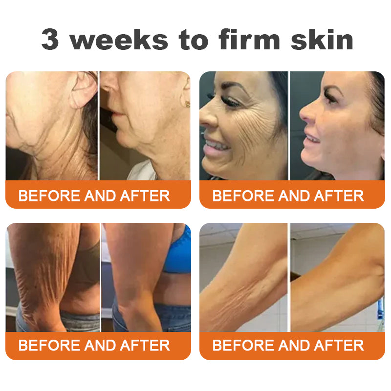 🥰Made and Shipped from UK🇬🇧Rolimey® Botox Bee Venom Firming Serum Stick(⏳LAST DAY 70% OFF)✨
