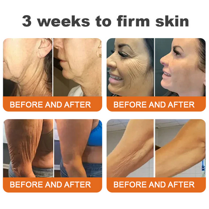 🥰Made and Shipped from UK🇬🇧Rolimey® Botox Bee Venom Firming Serum Stick(⏳LAST DAY 70% OFF)✨