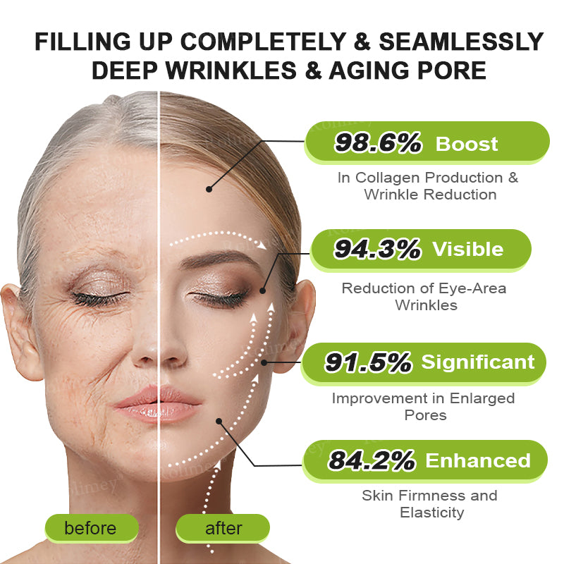 👨‍⚕️Made and shipped from the UK 💫Rolimey® Botox & Vita-A Retinol Shot Wrinkle-Lift Tightening cream - Last Day Promotion 70% OFF