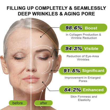 👨‍⚕️Made and shipped from the UK 💫Rolimey® Botox & Vita-A Retinol Shot Wrinkle-Lift Tightening cream - Last Day Promotion 70% OFF