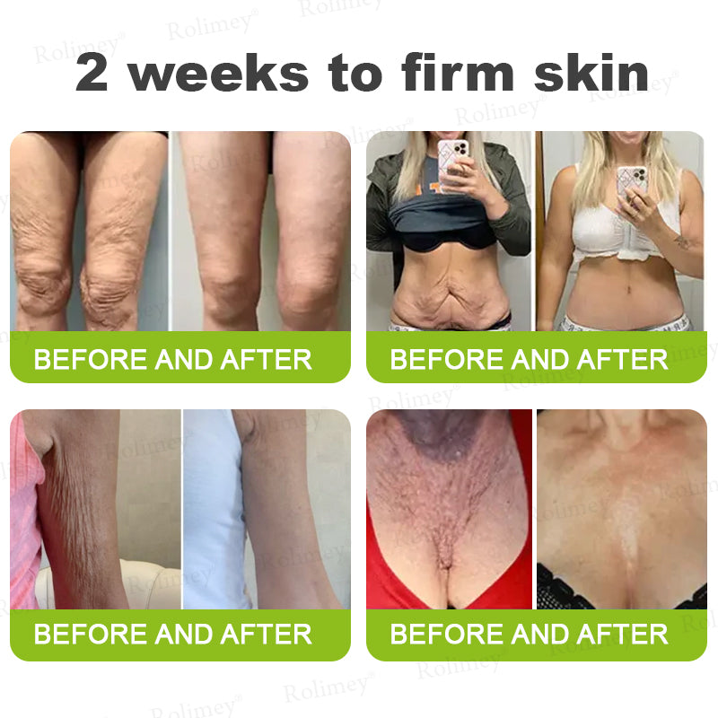👨‍⚕️Made and shipped from the UK 💫Rolimey® Botox & Vita-A Retinol Shot Wrinkle-Lift Tightening cream - Last Day Promotion 70% OFF