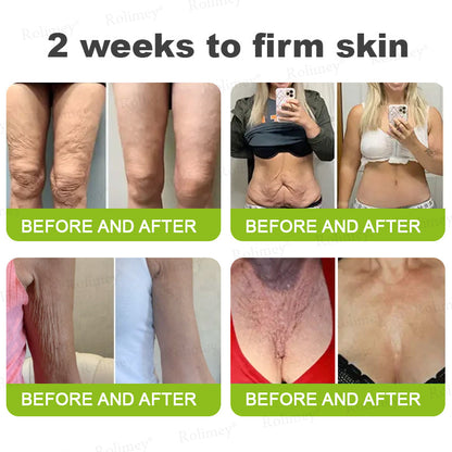 👨‍⚕️Made and shipped from the UK 💫Rolimey® Botox & Vita-A Retinol Shot Wrinkle-Lift Tightening cream - Last Day Promotion 70% OFF