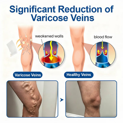 🇬🇧 🥰GFOUK® VeinEase Microneedle Care Patch⚡Instant Relief, Long-Term Results