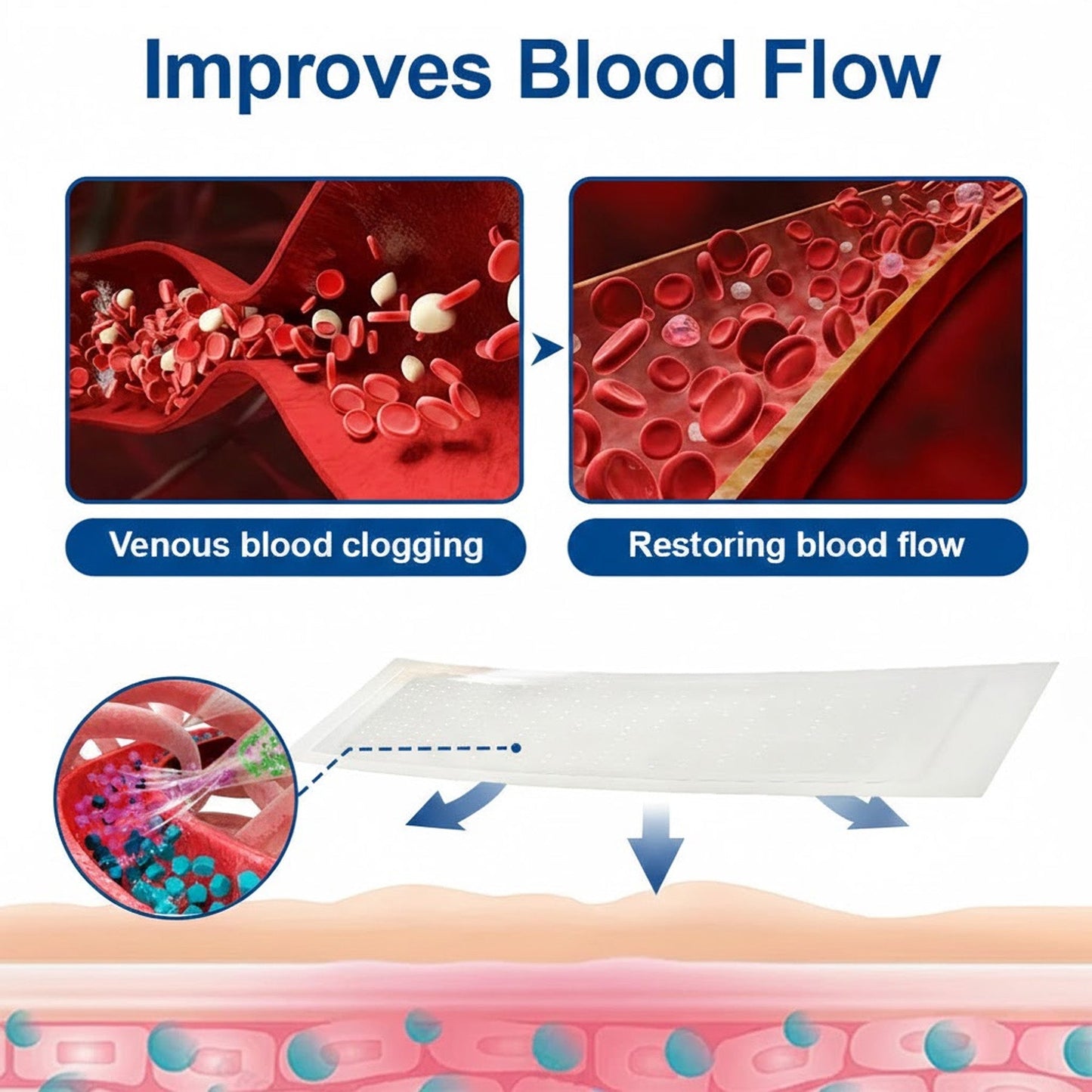 🇬🇧 🥰GFOUK® VeinEase Microneedle Care Patch⚡Instant Relief, Long-Term Results