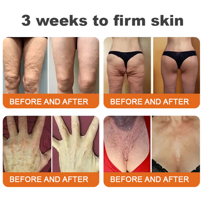 🥰Made and Shipped from UK🇬🇧Rolimey® Botox Bee Venom Firming Serum Stick(⏳LAST DAY 70% OFF)✨