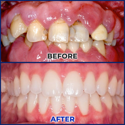 👩‍⚕️🦷Rolimey® BeeTakt Bee Venom Dental Treatment Drops Mouthwash
